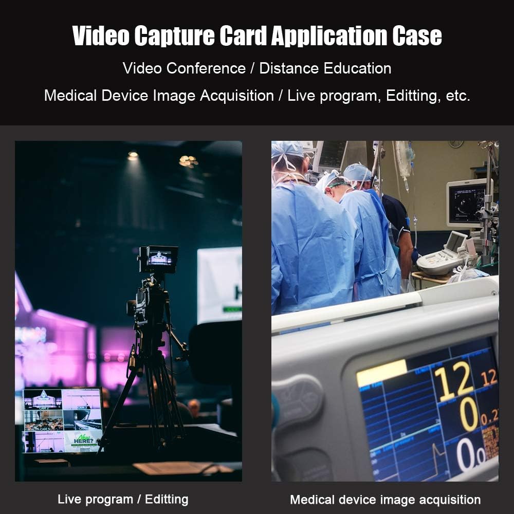 SDI to USB3.0 Video Capture 1080P 60fps A9841